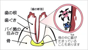 治療前の状態