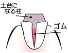 治療の流れのイメージ